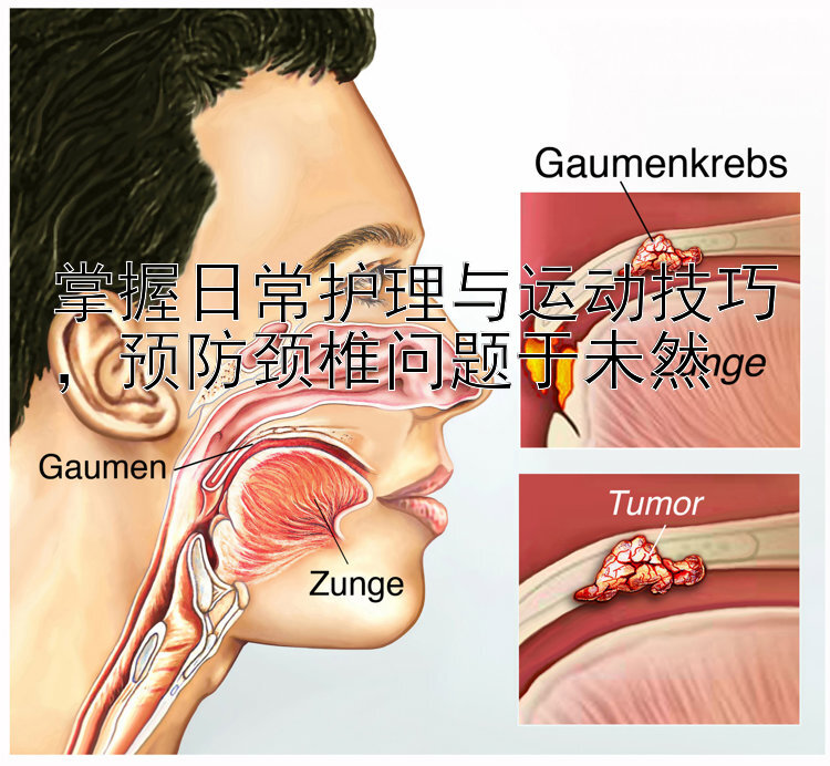 掌握日常护理与运动技巧，预防颈椎问题于未然