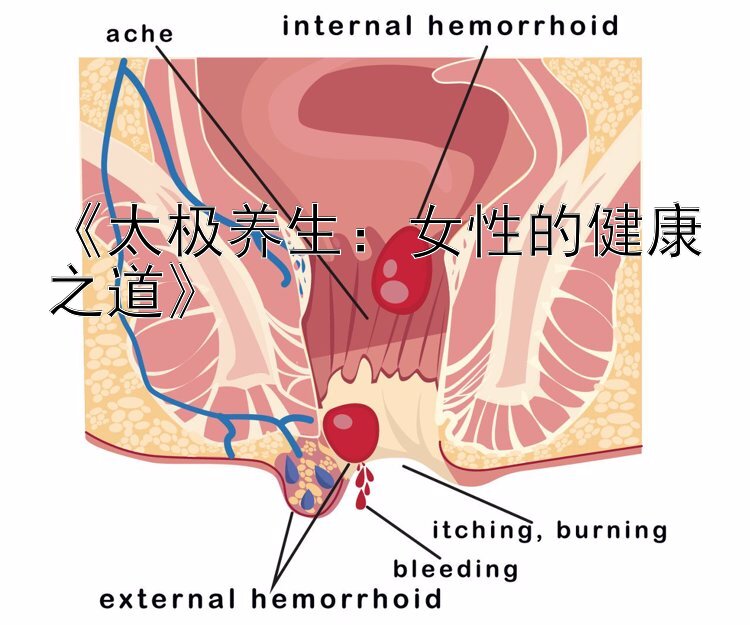 《太极养生：女性的健康之道》